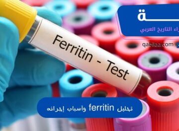 تحليل Ferritin Test